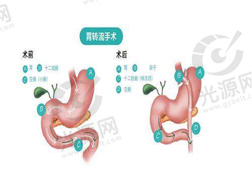 其他热门项目