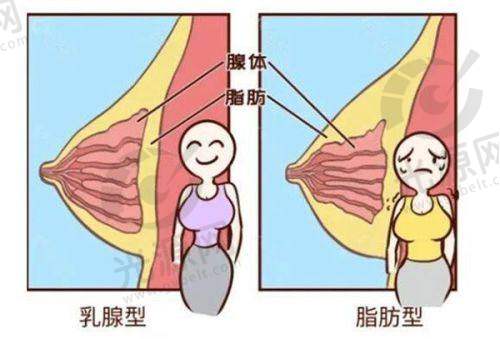 双眼皮手术项目